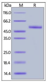 Human Frizzled-2, Fc Tag on SDS-PAGE under reducing (R) condition. The gel was stained overnight with Coomassie Blue. The purity of the protein is greater than 95%.